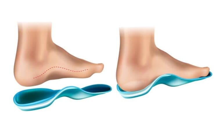 Foot Supports and Orthotics in Hiking Boots: Balancing Comfort, Stability, and Injury Prevention